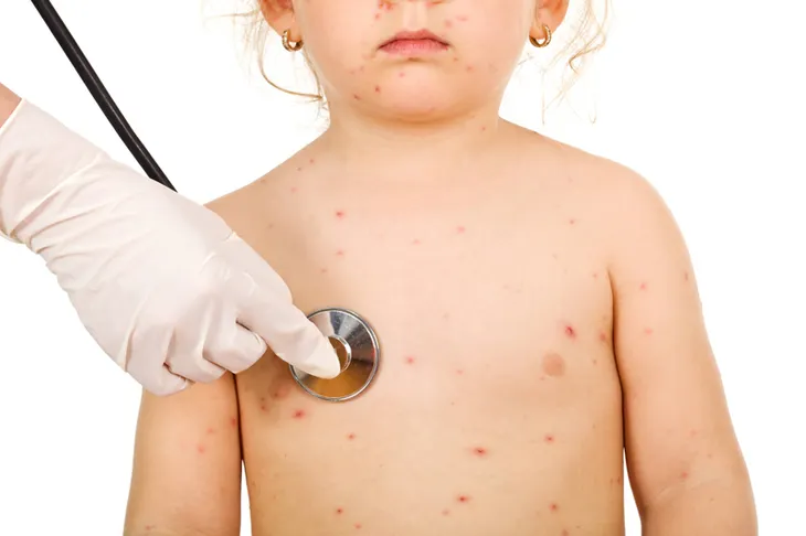 Epidemia continuă, încă trei noi cazuri de copii cu rujeolă în Galați