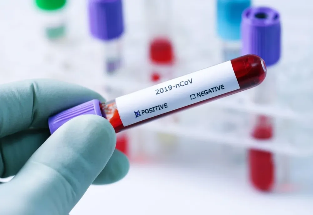 Alți 292 gălățeni confirmați ca fiind infectați cu SARS-CoV-2