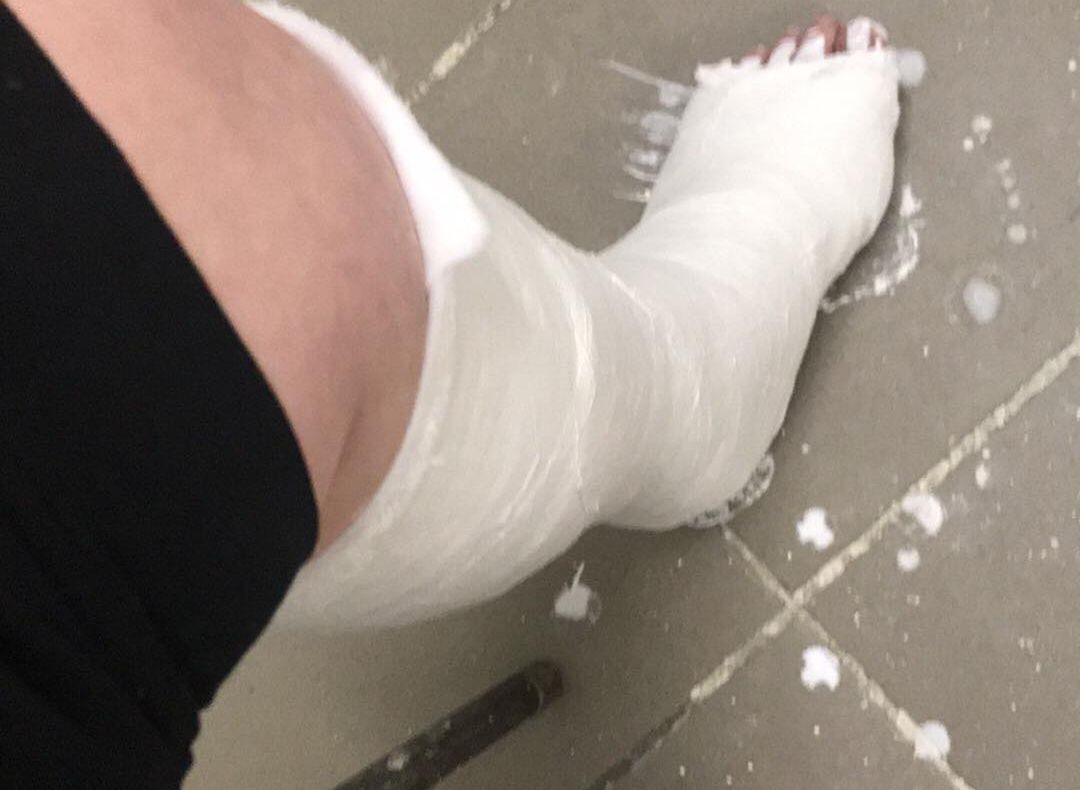 O gălăţeancă şi-a rupt piciorul din cauza extinderii terasei de la Spicu