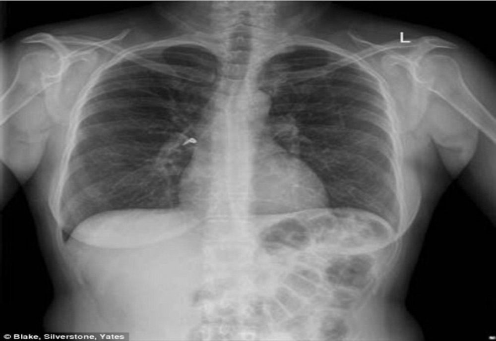 Noi echipamente pentru spitalele din Galați
