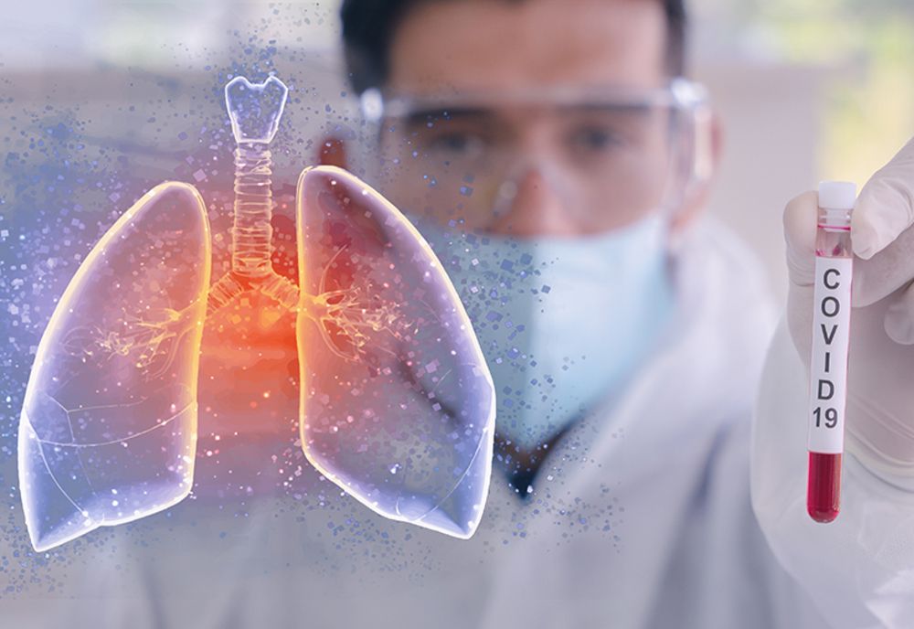 Alte 411 cazuri în ultimele 24 de ore