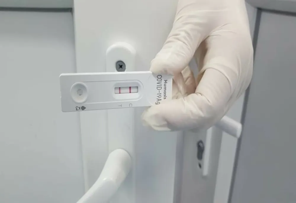 Situația epidemiei de infectări cu virusul SARS-COV-2 în județul Galați