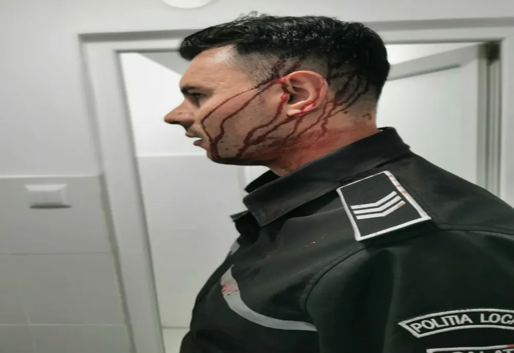 Un poliţist local a ajuns la spital după ce a fost lovit în cap cu un obiect aruncat de la geamul unui bloc din oraşul Galaţi  