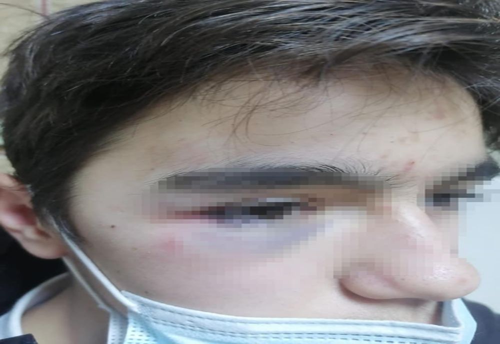 Elev bătut de colegi la Colegiul Naţional „Costache Negri” din Galați