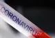Coronavirus Romania - Cazul 31 - Bărbat de 42 din Iași. A călătorit în Veneția