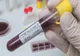 Alți 27 de gălățeni confirmați cu noul coronavirus